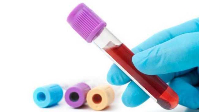 blood test for Breast Cancer