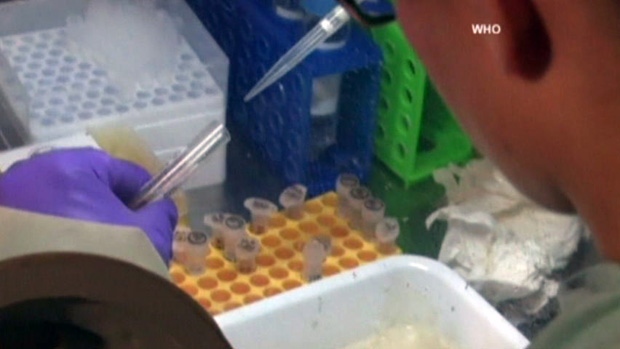 Ebola 'cocktail' developed at Canadian and U.S. labs
